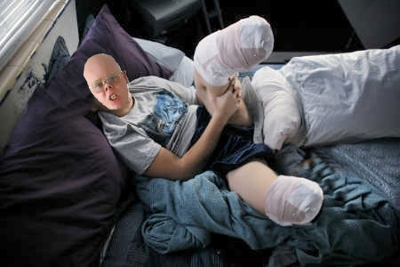 Cyril Dilligaf amputated both legs over a fear of his own feet