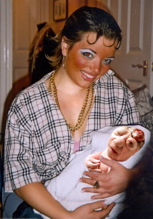 Chantelle Vagasille poses with her hideously deformed baby